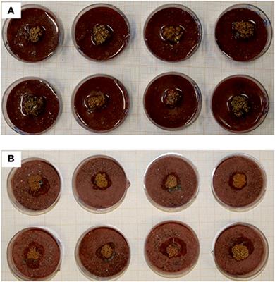 Cellular Responses of the Lichen Circinaria gyrosa in Mars-Like Conditions